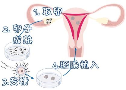 妇科